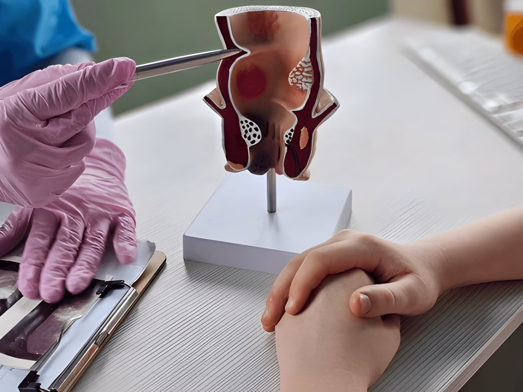 coloscopie Algérie | coloscopie Algérie kacel , endoscopie alger , endoscopie sur alger